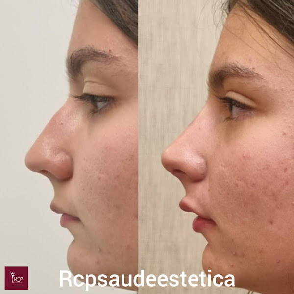 Foto 3 de Rcp saúde e Estética - Clínica Estética São Gonçalo