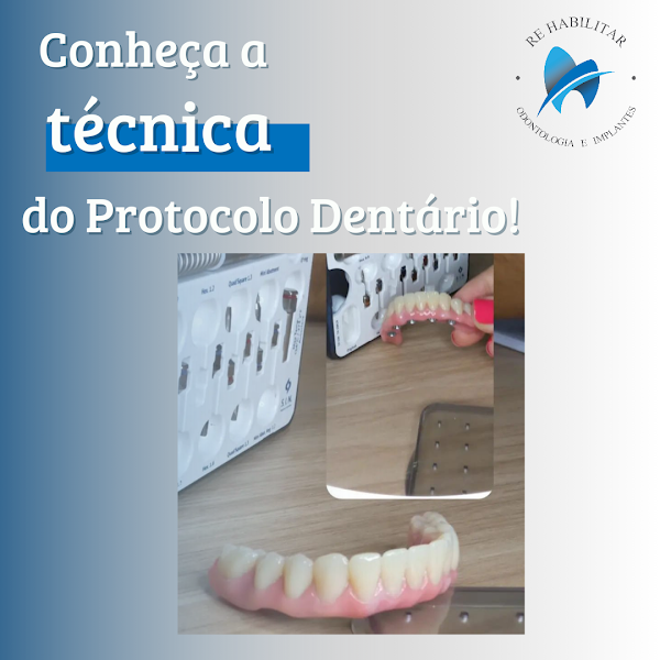 Foto 3 de Re Habilitar Odontologia e Implantes l Dentista em Juiz de Fora