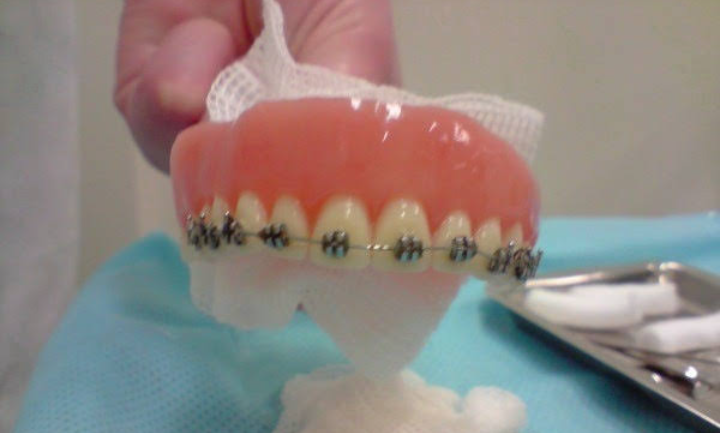 Foto 3 de Reab Odonto / Prótese Dentária