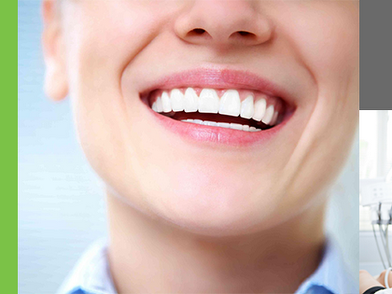 Foto 8 de Reabilitação Oral