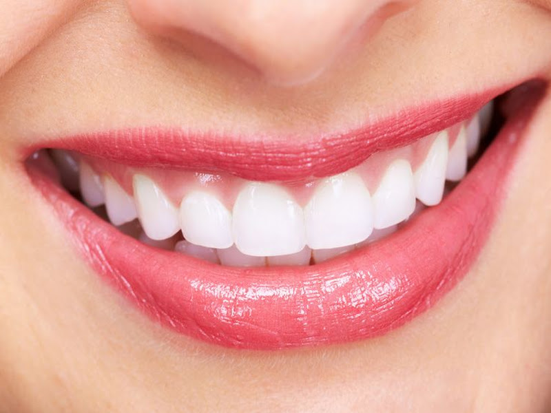 Foto de Reabilitê Odontologia - Dentista em Goiânia: Implantes e Ortodontia Jardim América