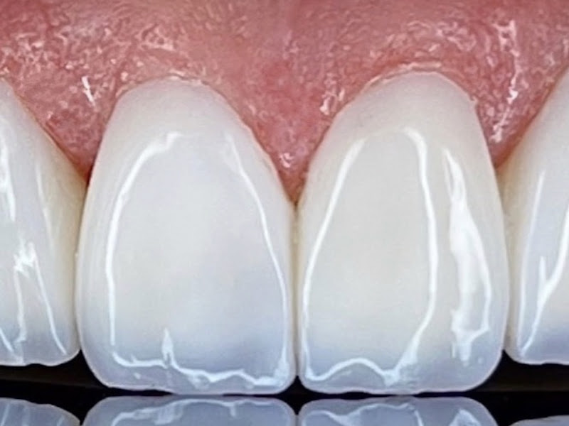 Foto 6 de Reabilite Odontologia Palmas