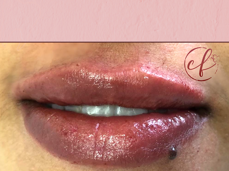 Foto 7 de REAL FACE ODONTOLOGIA