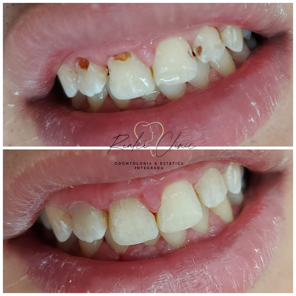 Foto 3 de Realce Clinic Odontologia & Estética Integrada | Dra Roseli C. & Co. | Dentistas em Diadema