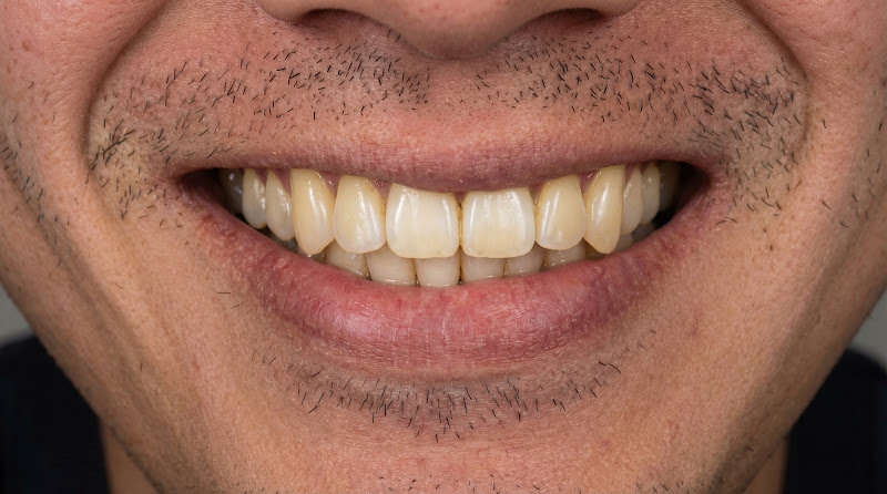 Foto 3 de Realce Odontologia