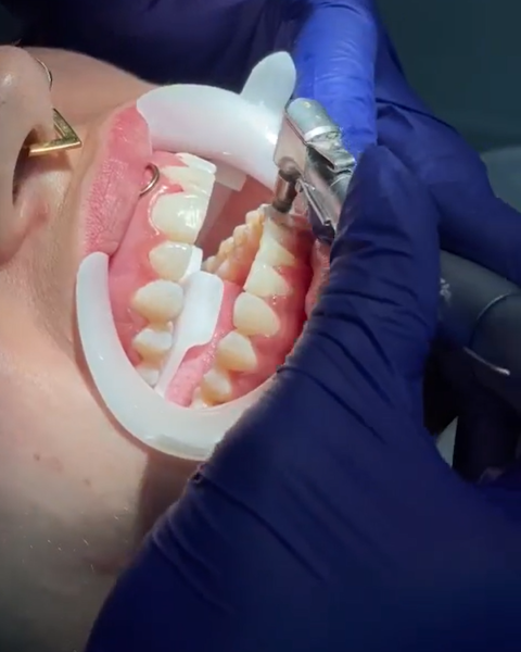 Foto 3 de Realce seu Sorriso Odontologia