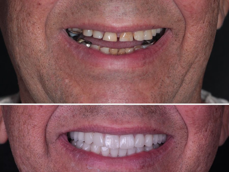Foto de Recreio Odontologia | Especialistas em Reabilitação Oral, Implantes e Harmonização Orofacial há 15 anos | RJ