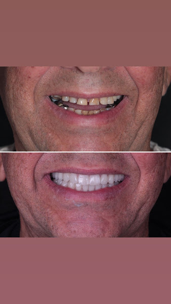 Foto 2 de Recreio Odontologia | Especialistas em Reabilitação Oral, Implantes e Harmonização Orofacial há 15 anos | RJ