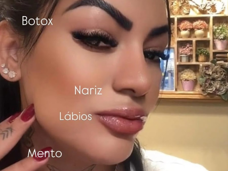 Foto 2 de Rede OrtoEstética Parangaba