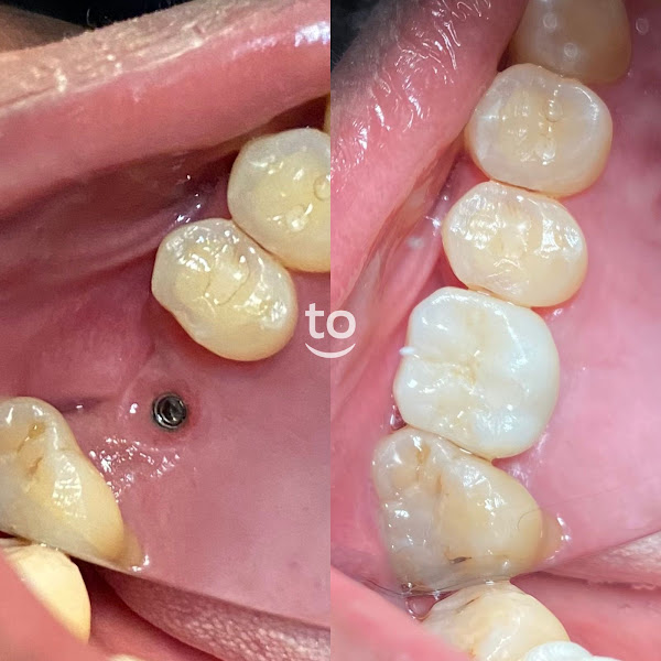 Foto 3 de REDEORTO Araguaína