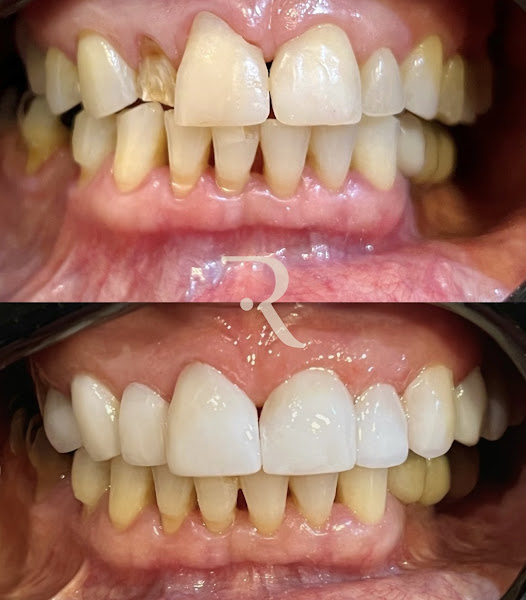 Foto 2 de Refinar Odontologia Especializada - Dentista em Paciência