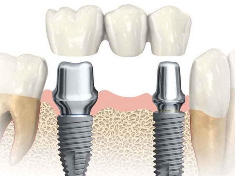 Foto 3 de Refinar Odontologia Especializada - Dentista em Paciência