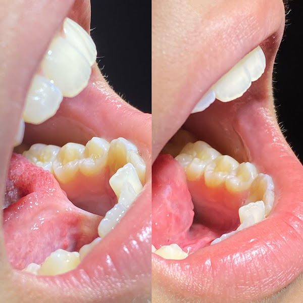 Foto 2 de Regenera Odontologia Especializada