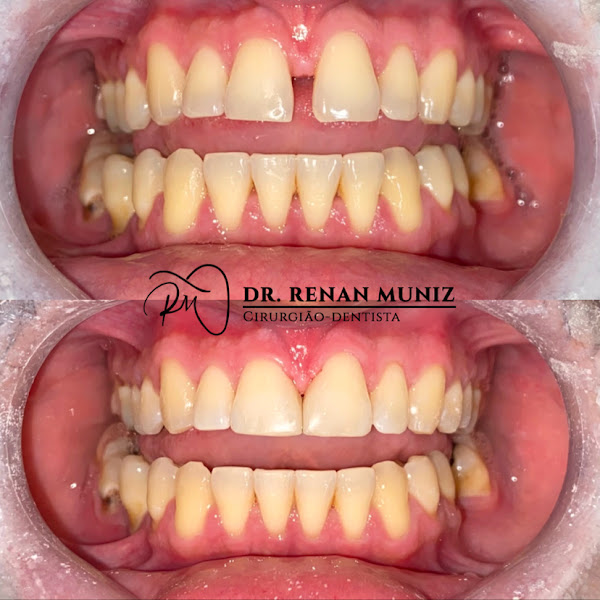 Foto 2 de Renan Muniz - Dentista em Aparecida de Goiânia e Região