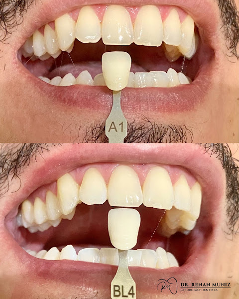Foto 3 de Renan Muniz - Dentista em Aparecida de Goiânia e Região