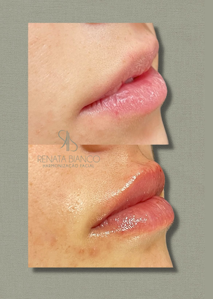 Foto 3 de Renata Bianco Odontologia
