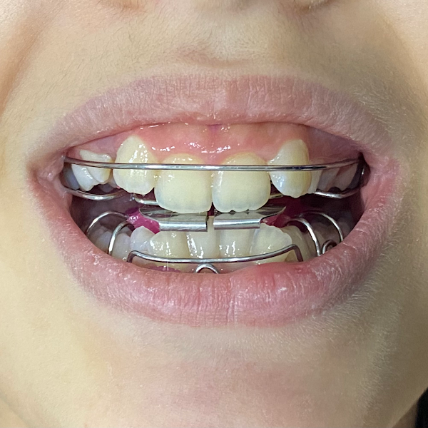 Foto 2 de Renato Andrade Ortodontia