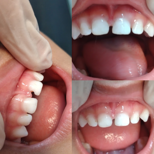 Foto 2 de Renova Kids Odontologia Integrada