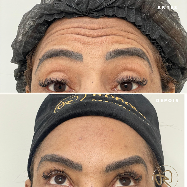 Foto 2 de Renova Odontologia Facetas Estéticas e Harmonização Facial Montes Claros