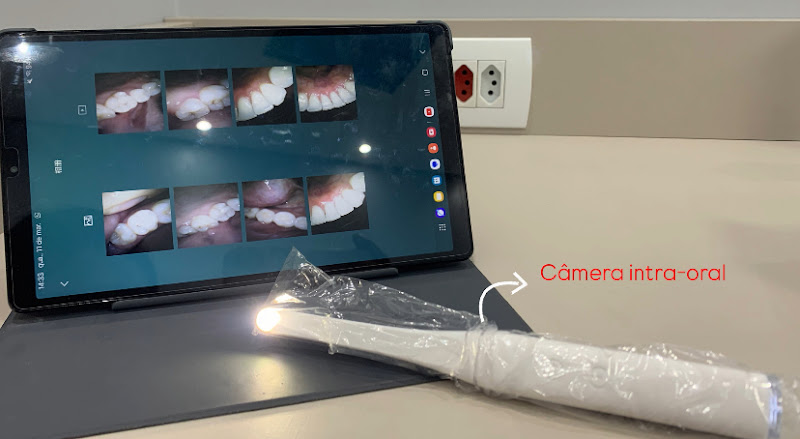 Foto 3 de Renova Sorrisos - Odontologia Especializada / Dentista