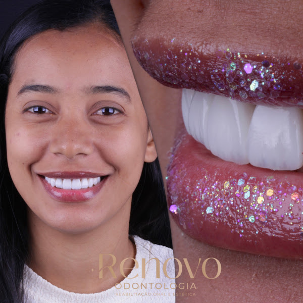 Foto 3 de Renovo Odontologia - Dra Bárbara Cibele
