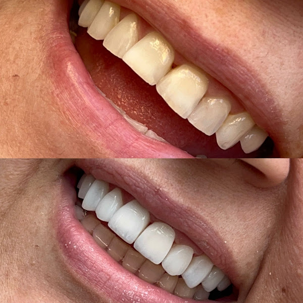 Foto 2 de Reslumbre Imperatriz - | Consultório Odontológico | Dentistas especializados