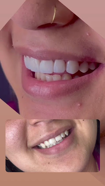 Foto 4 de Reslumbre Imperatriz - | Consultório Odontológico | Dentistas especializados