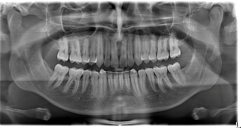 Foto 3 de Revelação Imagens Orais - Asa Norte