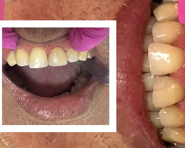 Foto 2 de Revitalizart - Odontologia e Estética Facial Santa Amelia