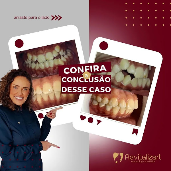 Foto 3 de Revitalizart - Odontologia e Estética Facial Santa Amelia