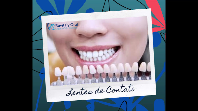 Foto 3 de Revitaly Oral - Implantes e Próteses