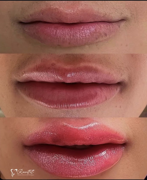 Foto 4 de Revittal Odontologia