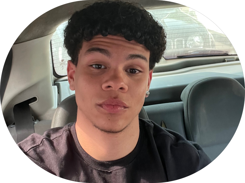 Foto 5 de Revittale Odontologia | Ortodontista | Invisalign | Implantes | Tratamento do ronco e apneia do sono | Feira de Santana Ba