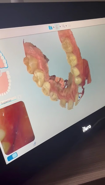 Foto 3 de RF Odontologia Dra Renata Frazão