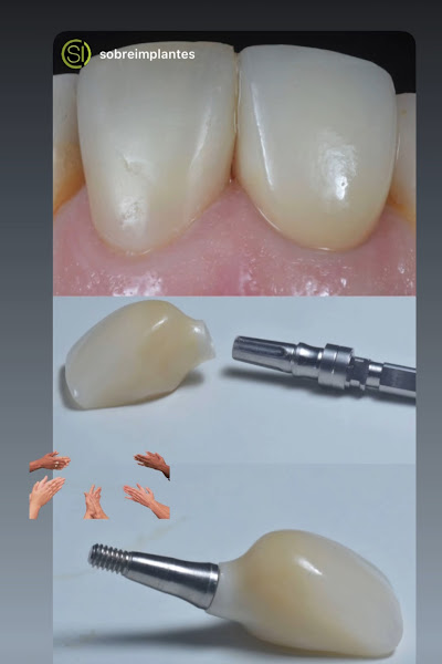 Foto 3 de RHB Prótese Dentária