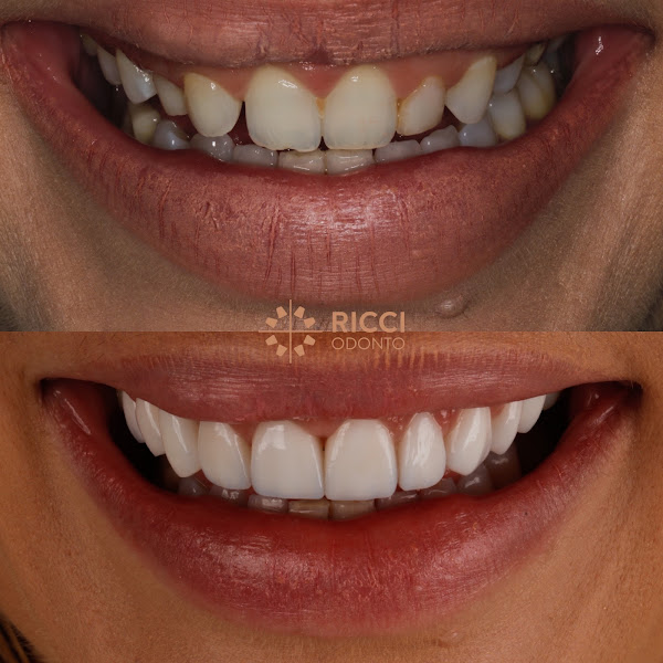 Foto 2 de Ricciodonto