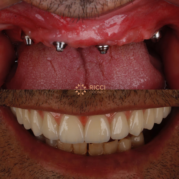 Foto 3 de Ricciodonto