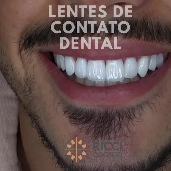 Foto 4 de Ricciodonto