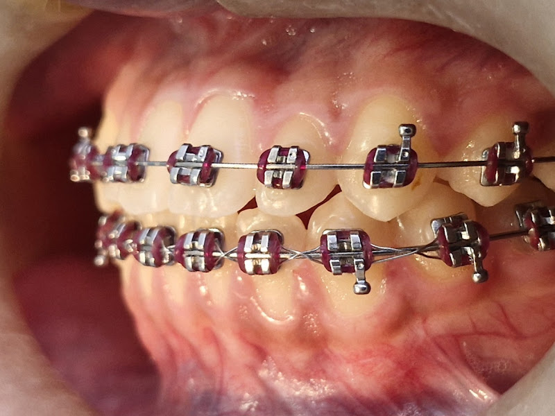 Foto 4 de Rident Clinicas Odontológicas