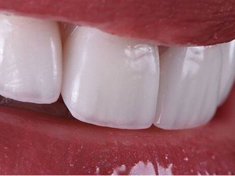 Foto 2 de RIDERE ODONTOLOGIA ESPECIALIZADA E ESTETICA