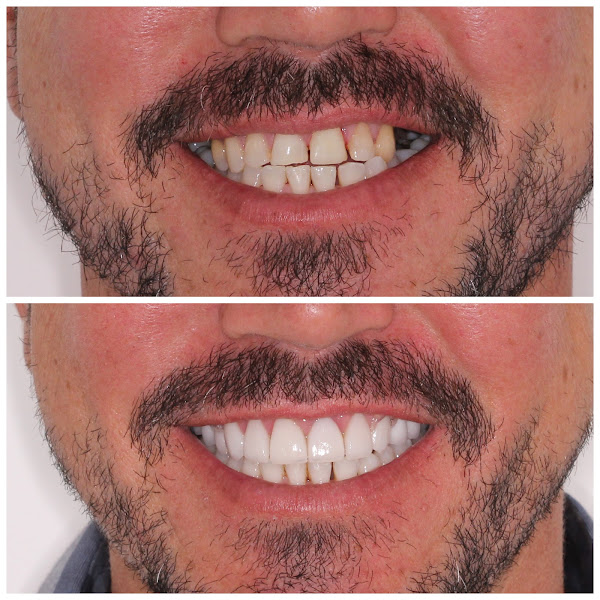 Foto 4 de Rir Odonto M`Boi Mirim