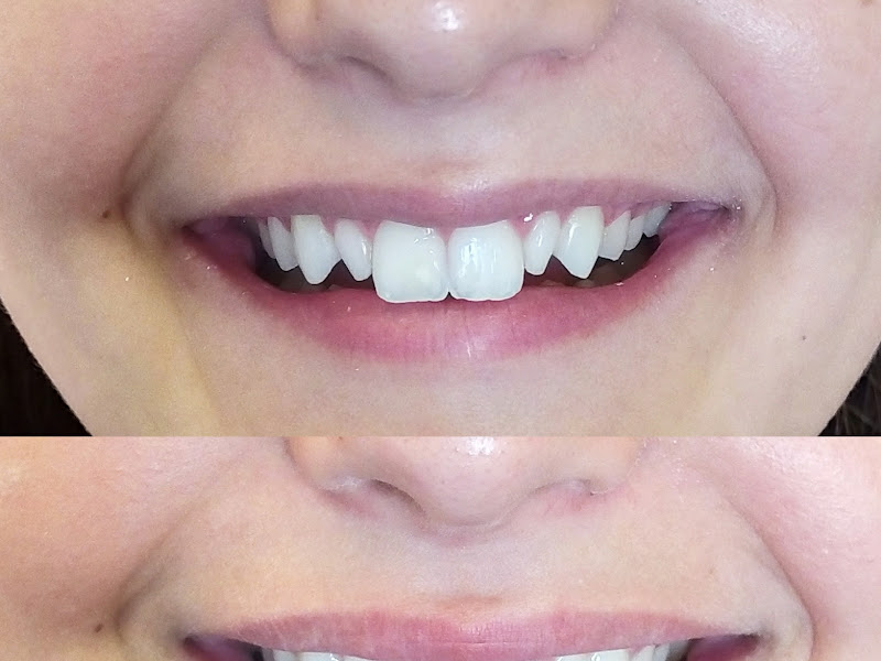 Foto 7 de Risate Odontologia Especializada