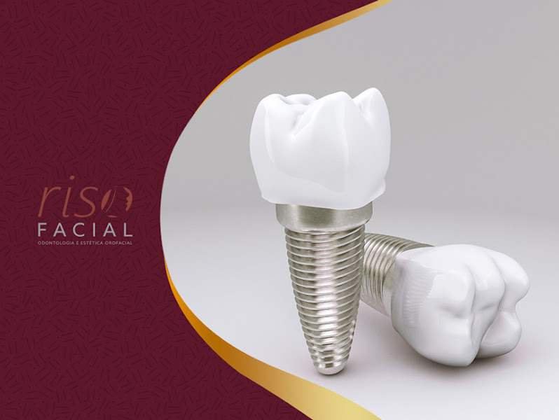 Foto de Riso Facial - Clínica Odontológica e Estética Orofacial - Santo André