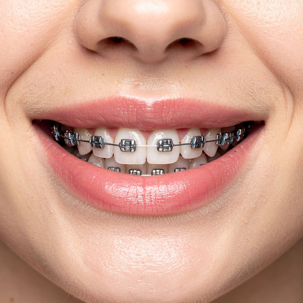 Foto 3 de Riva Odontologia e Saúde