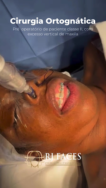Foto 2 de RJ FACES cirurgia buco-maxilo-facial