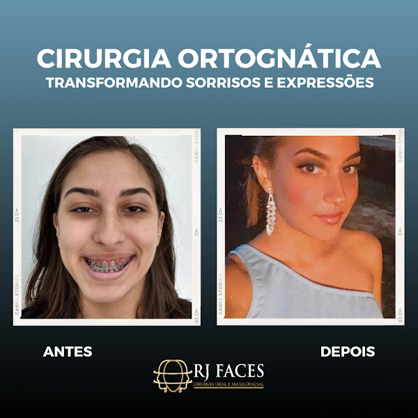 Foto 3 de RJ FACES cirurgia buco-maxilo-facial