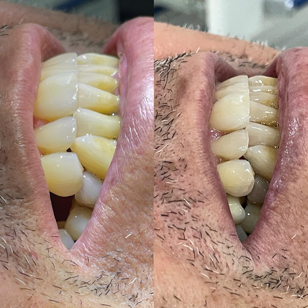 Foto 2 de RM Implantes