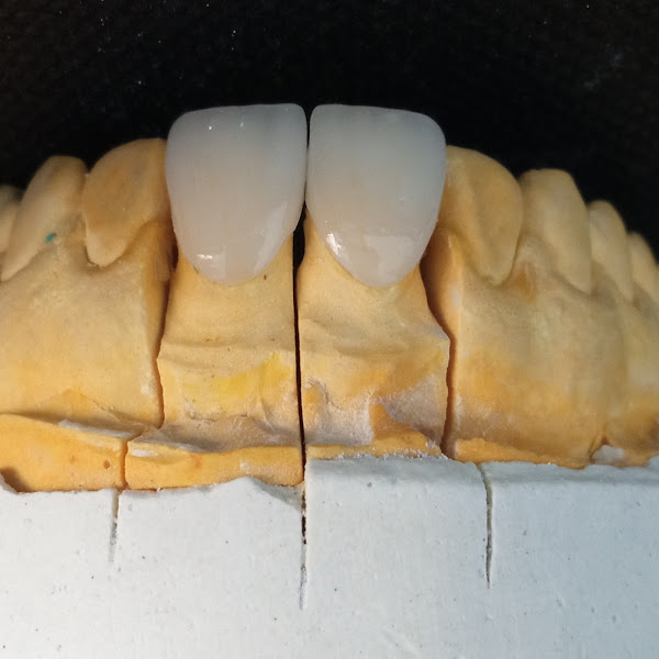 Foto 2 de RMS Odontologia Estética e Funcional