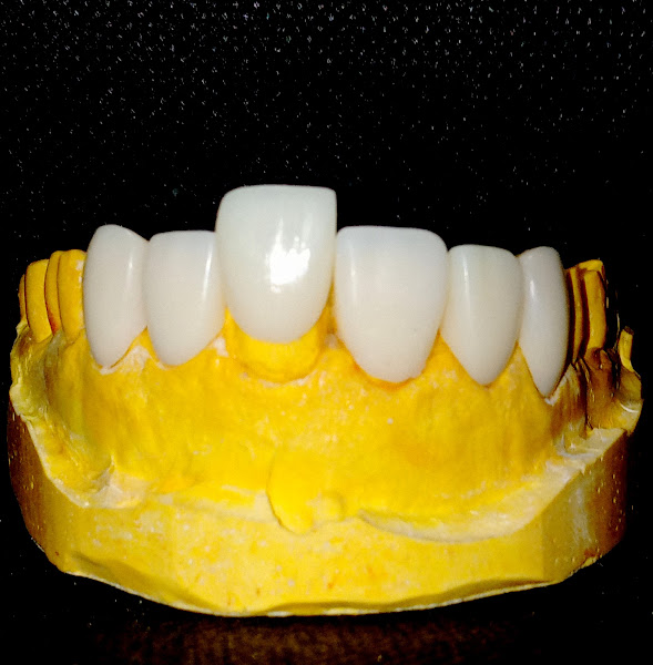 Foto 3 de RMS Odontologia Estética e Funcional