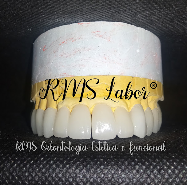 Foto 4 de RMS Odontologia Estética e Funcional